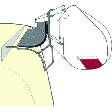 Kit Joint Rain Guard